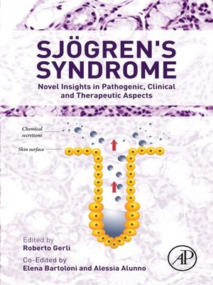 cover image of Sjogren's Syndrome